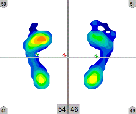 足圧分布のイメージ